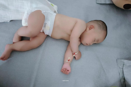 七台河宝宝头上长痱子